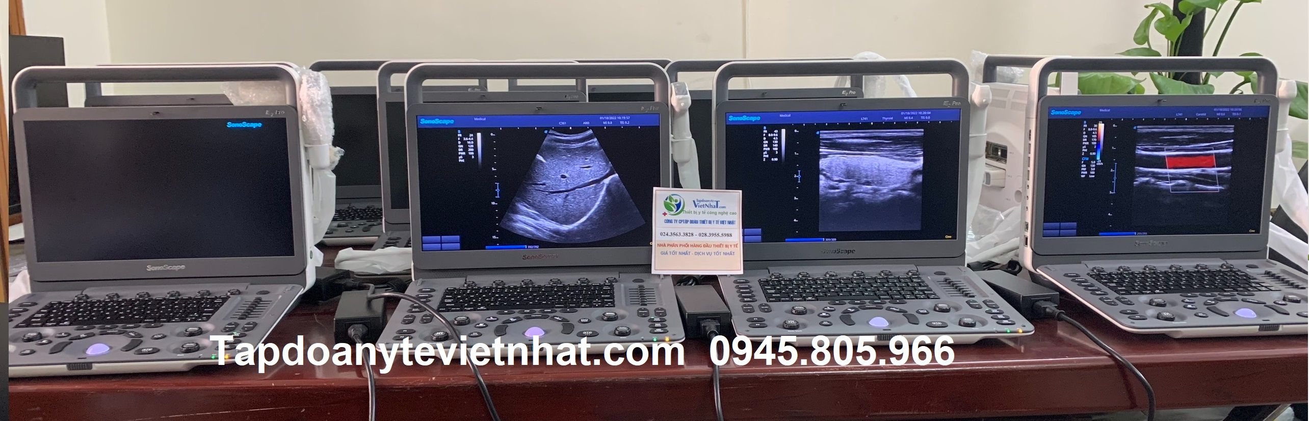 Các dòng máy siêu âm xách tay giá rẻ chất lượng nhất hiện nay